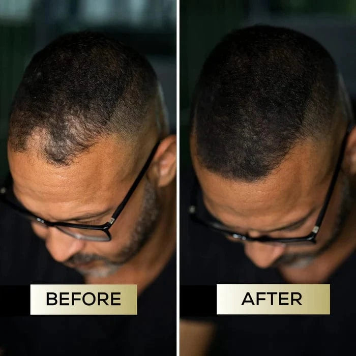 Scalp Concealer - For naturally fuller & confident-looking hair