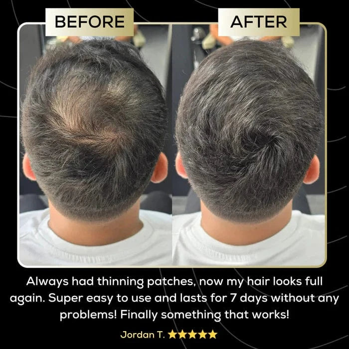 Scalp Concealer - For naturally fuller & confident-looking hair