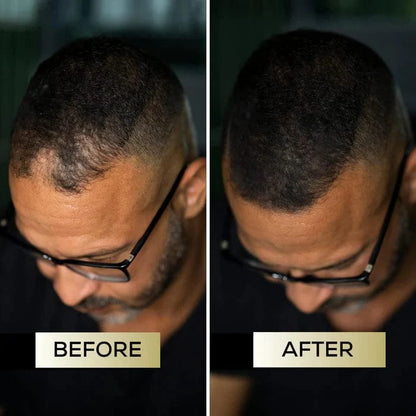 Scalp Concealer - For naturally fuller & confident-looking hair