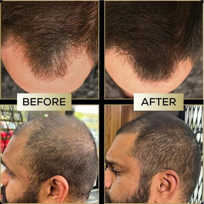 Scalp Concealer - For naturally fuller & confident-looking hair