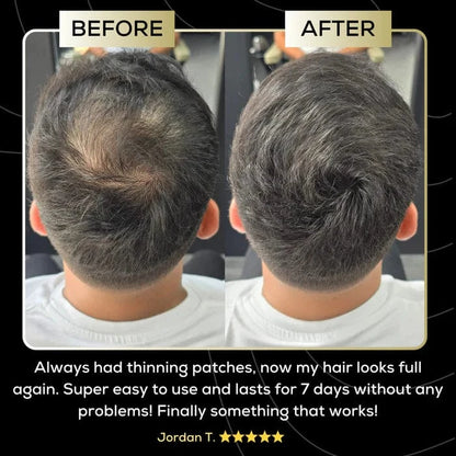 Scalp Concealer - For naturally fuller & confident-looking hair